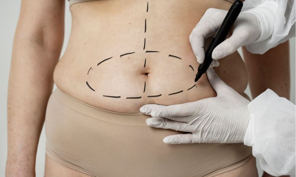 surgery to reduce stomach size